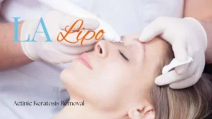 Woman receiving Actinic Keratosis Removal Treatment Livingston