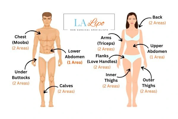 LA LIPO Cryolipolysis Areas Livingston