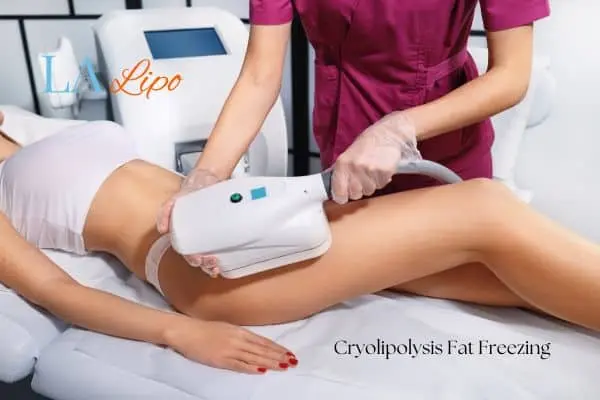 Woman receiving coolsculpting Livingston treatment on her thighs