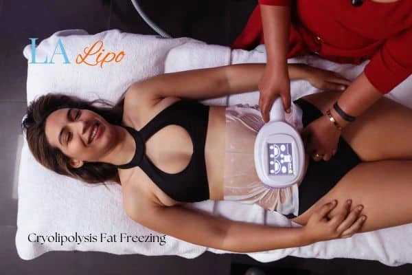 woman getting cryolipolysis Livingston