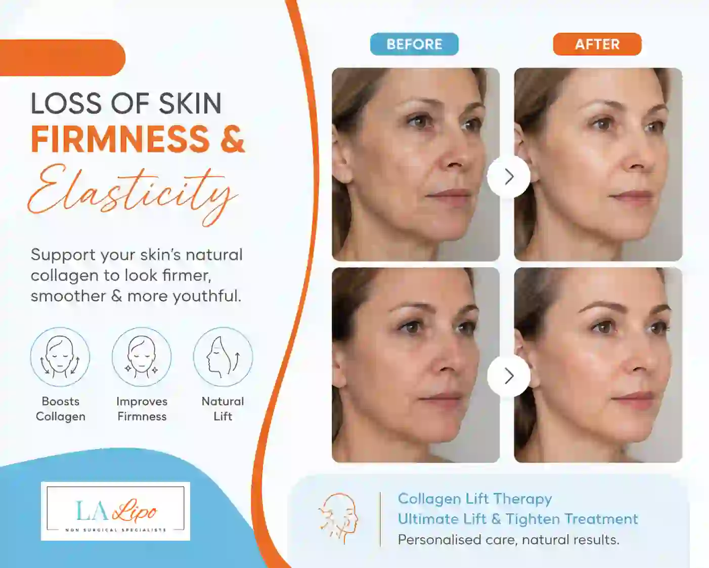 Sign #7: Loss of Skin Firmness and Elasticity Livingston